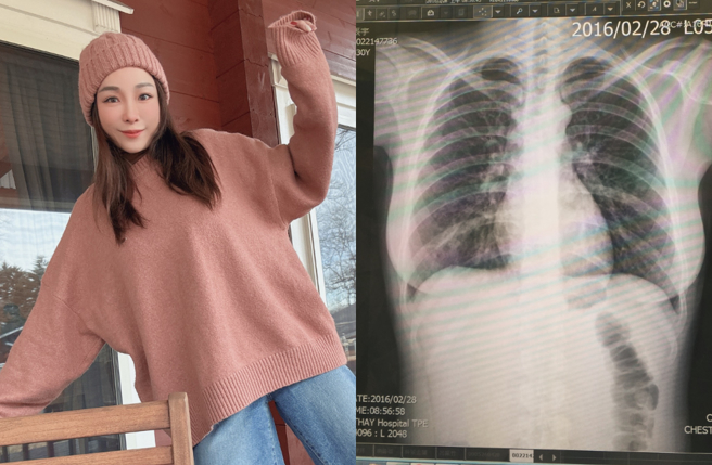 張宇得流感住院急救，見大S病逝很感傷。（圖／臉書 張宇）