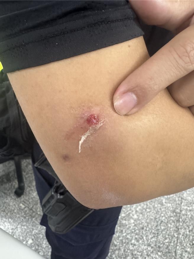 員警受傷。（警方提供）