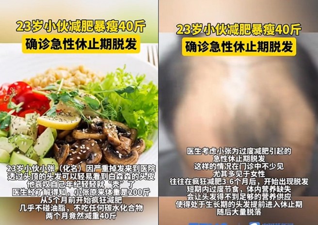 大陆一名23岁年轻男子，因为疯狂减肥，导致营养不良，头髮大量掉落变成地中海。（翻摄微博）