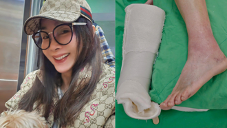 陳美鳳為挺胡瓜「骨裂未癒仍堅持登台」 最新傷況曝