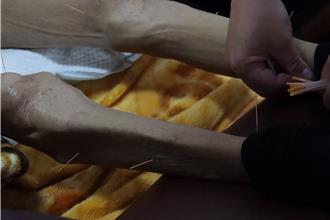 癌友警惕！味觉改变恐是「恶病质」徵兆