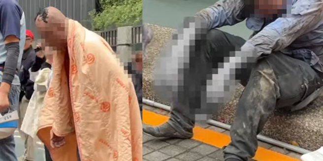 当时一名在11楼装修的工人在气爆当下感到受有如「10级地震」上下剧烈晃动，有工人头髮、双手遭严重烧烫伤。（图／翻摄画面）