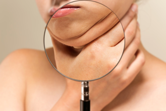 頸部死穴曝光 醫揭3危險行為：種草莓恐中風