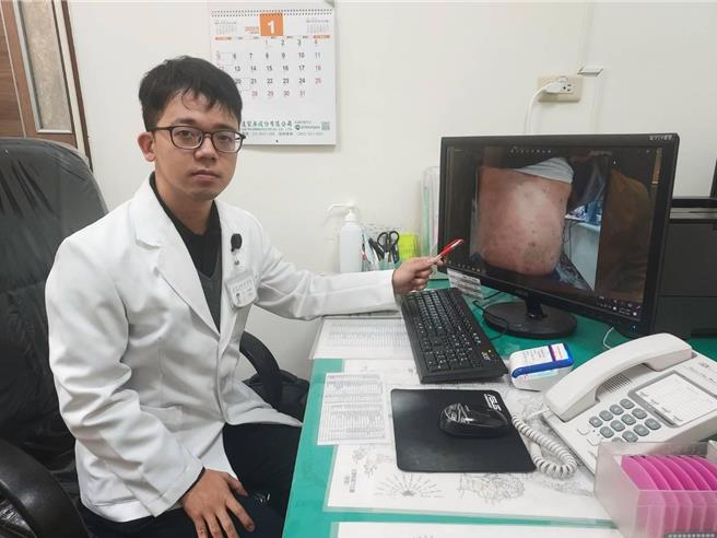 现代人皮肤病灶多，如何预防及保养？卫福部新营医院中医生何柏逸表示，除了饮食做好控制、个人卫生清洁外，适度运动也非常重要。（新营医院提供／张毓翎台南传真）