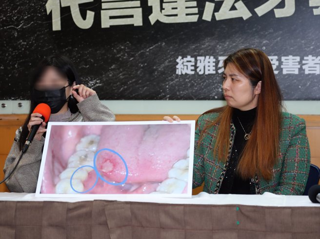 绽雅隐形牙套受害者自救会在律师黄伟琳（右）陪同下召开记者会，表示许多消费者因为相信网红推荐的品牌，结果矫正不成，还造成齿列的永久性伤害。现除公布绽雅隐形牙套违法事项，更要求网红下架代言，不要再助长黑心厂商。（陈君玮摄）