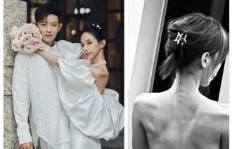 敖犬愛妻自曝曾「憂鬱症暴瘦剩36.6kg」 背部裸身全見骨頭