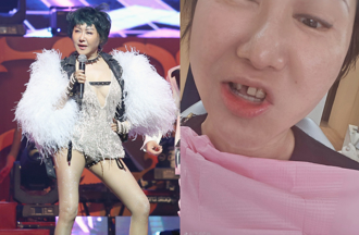 藍心湄門牙突變一個洞！「挖肉」驚悚過程公開狂哀嚎