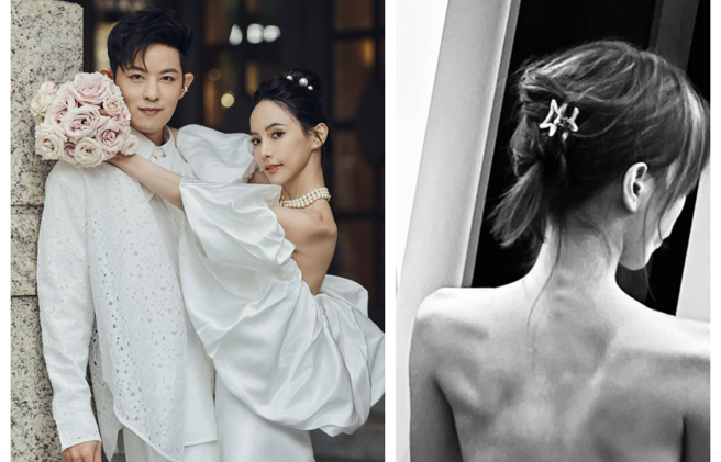 发发自曝曾罹患忧郁症暴瘦。（图／翻摄piglettickle IG）