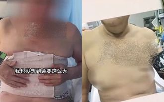 日嗑瓜1公斤 陸大叔「罩杯UP」！網喊：現在吃來得及嗎