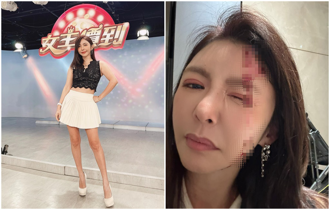 前甜心主播被尪害慘摔！「頭殼破洞」血流如注送醫縫2針