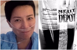 50歲女星乳癌復發 抽1公升血水 醫：常發生在末期