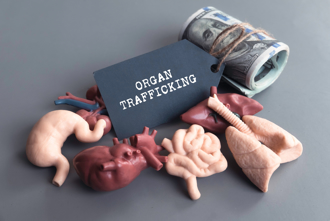 波蘭邊防逮捕烏克蘭女子 涉非法摘取、販賣56顆腎臟