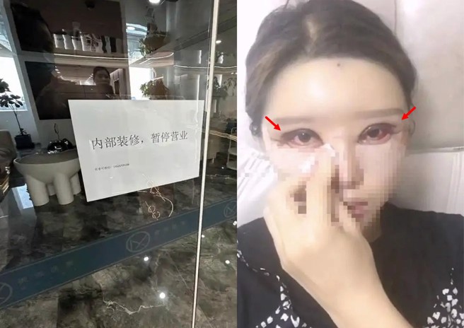医美诊所已经停业，受害女子成十级伤残，根本无法阖眼。（翻摄上游新闻）