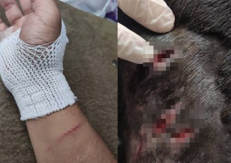 巨犬羅威納沒繫繩「突抓狂」 3次猛咬路口人狗！恐怖傷勢曝