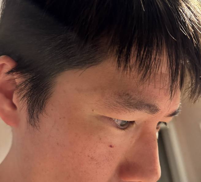 旅英亲子作家QQmei透露遇到有歹徒企图入屋的惊魂事件，老公还因此脸上挂彩。（图／摄自FB@QQmei）