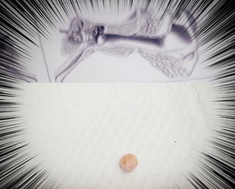 9岁女童喊「妈！我耳朵有东西」却不痛 医一夹超惊吓