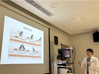 屏东荣总引进「内视镜黏膜下剥离术」 助癌症患者找回健康