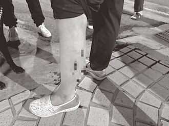 蘆洲 米克斯跳車咬人 飼主恐罰1.5萬