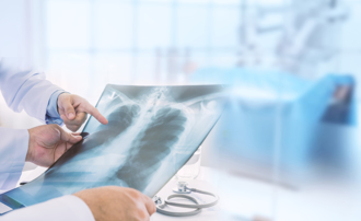 肺癌治療新突破！次世代基因定序助攻 精準打擊癌症