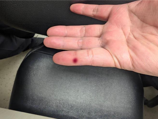 桃园市议员黄琼慧爆料，1名疾管署桃园机场检疫护理师21日在机场，因同事乱丢抽过血旅客针头而被扎伤，因担心感染传染病就医，事后请假却被刁难，因须持续追踪、服用抗爱滋抗病毒药物，加上长官态度，只好求助身心科。（桃园市议员黄琼慧提供）