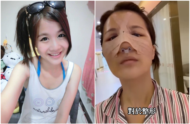 网路女歌手萧小M大方坦承自己整形。（图／摄自IG@xiaolittlem、FB@萧小M）