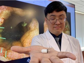 膠囊內視鏡救命 中榮精準診斷8歲童消化道出血