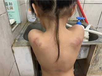 台東縣某國小驚傳老師施暴特教生  伍麗華要求教育部徹查