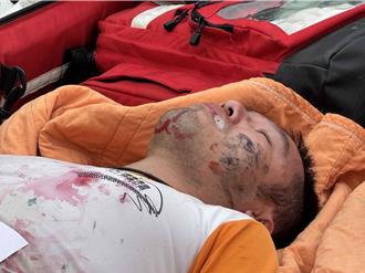 嘉義重大傷病患演練  素人演員「自製白沫」演技超逼真