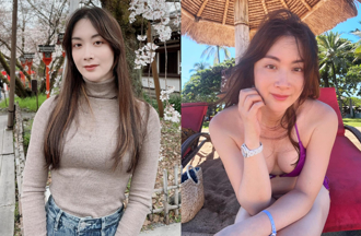 最美檢察官去年才抽脂豐胸 自曝又動「縮腰手術」：6根肋骨骨折