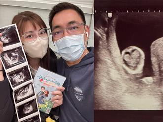 8點檔女星喜懷二胎！寶寶超音波照驚喜藏「無敵愛心」