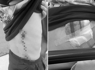 西门町爆随机砍人！韩国留学生背部中刀流血 警逮酒醉犯嫌