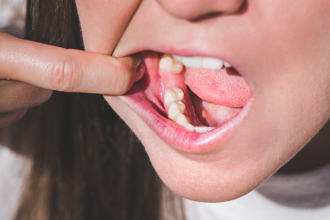 不是老了！新研究曝掉牙「幕後黑手」 醫嘆：別再吃了