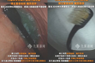 吃播主催吐「竟吞下15公分牙刷」！ 掉到胃部緊急送醫網嚇翻