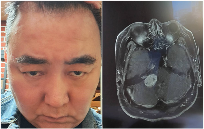 徐亨的人生陷入低潮，破产、离婚又生病。（徐亨脸书）