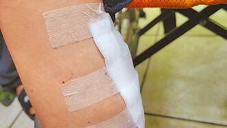 花蓮 飼犬咬死貓又傷童 縣府將沒入