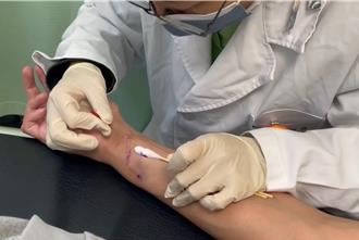 電梯工不慎受傷手臂神經全斷 「小針刀」助重返職場