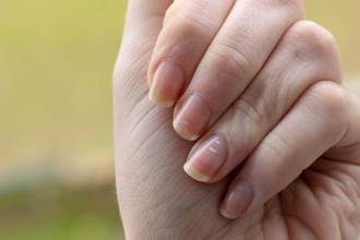 月牙不見代表生病了？醫示警：指甲2情況速就醫