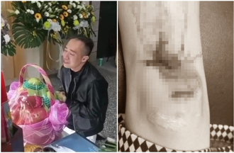 網紅安哥遭控家暴！昔狠嗆：殺妳全家 女友被「打到見骨」照曝光