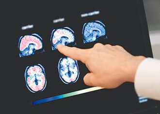 健康新知－腦部健康早知道 失智攻防 精準醫療早篩扮關鍵