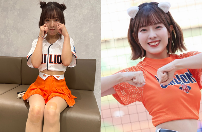 希美在大巨蛋奔跑時重摔，整整翻了一圈，經紀公司也曝光她的傷勢。（圖／藝維克國際娛樂提供、希美IG）