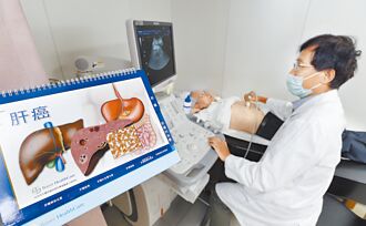 40歲以上 擬7月起免費肝篩檢