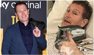 《哈利波特》男星爆命危紧急动手术「切颈部4块骨」病况曝光