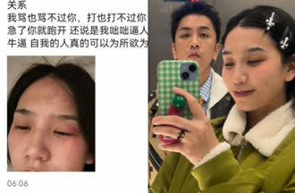 《青春有你2》女星突痛訴「家暴男不得好死」！老公發文道歉了