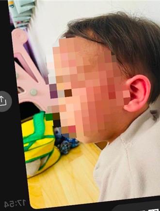 新北板橋傳保母虐童　幼童疑遭「愛的小手」打傷臉