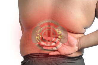 研究揭發胖「隱藏元凶」 營養師列5危害：還傷腎