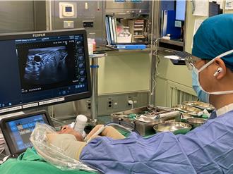 頭頸腫瘤怕術後留疤 粉領靠「1消融術」免開刀除病灶