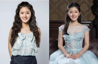 趙露思露面「下巴變尖」再陷整形疑雲 網毒舌吐槽：尖到可開瓶