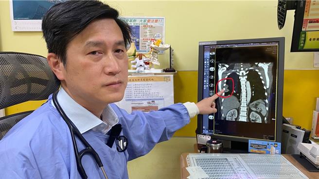 员荣医院医疗副院长涂川洲所指处显示患者感染类鼻疽菌，肺部有两处脓疡。（员荣医院提供／叶静美彰化传真）