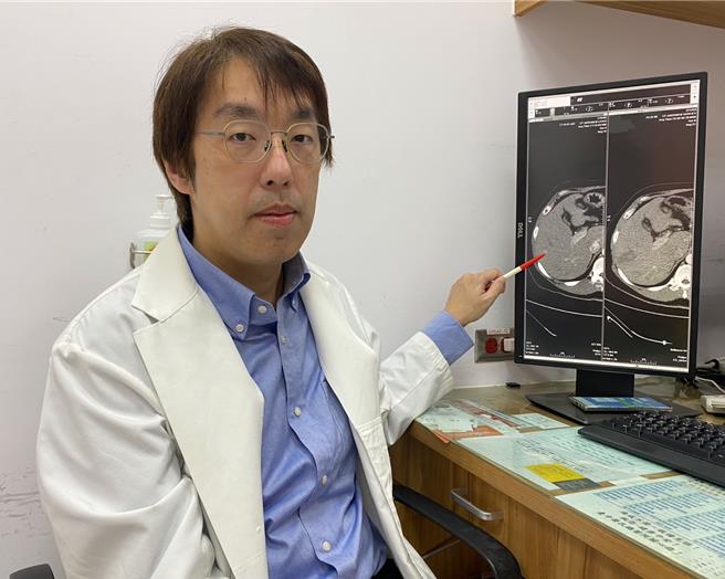 台中荣总胃肠肝胆科医师李少武说明，经安排电脑断层检查后，发现病患有0.5公分復发肝癌（手指处），进行射频消融术治疗后，追踪状况良好。（冯惠宜摄）