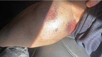 疑農會改選惹風波 彰化芳苑農會理事長遭球棒攻擊